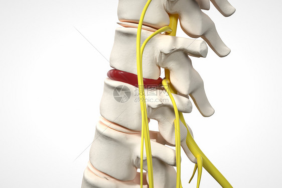 腰椎局部骨架突出场景图片