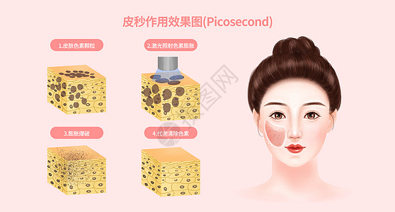 电视墙效果图皮秒作用效果图插画