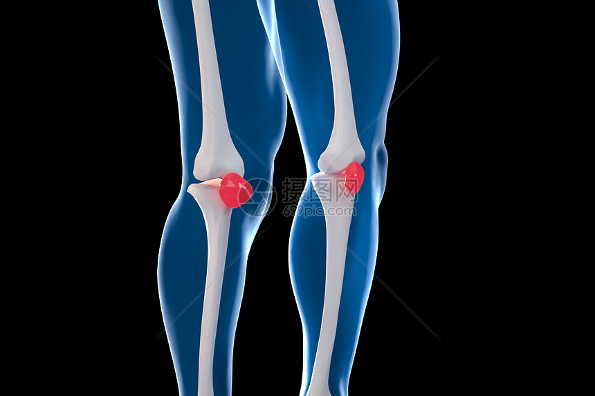 膝关节半月板损伤图片素材 正版创意图片 摄图网