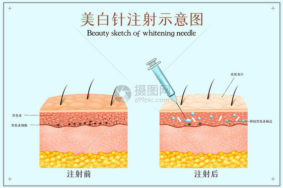 美白针注射示医美配图图片