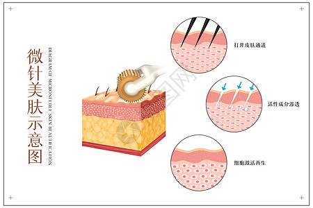 塑性微针美肤医美配图插画