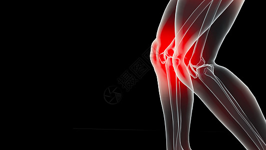 C4D膝关节疼痛场景图片
