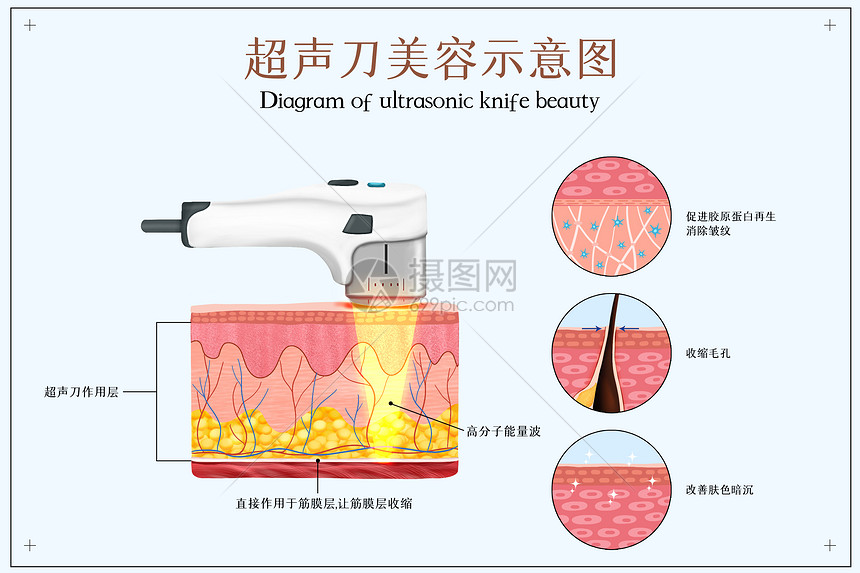 超声刀美容医美配图图片