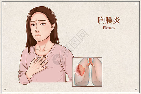 胸膜炎医疗插画图片