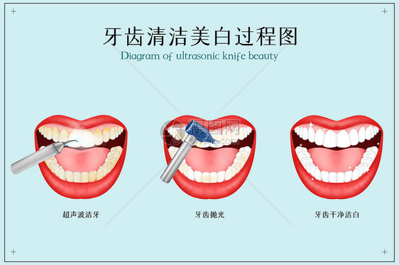 牙齿清洁美白医疗配图图片