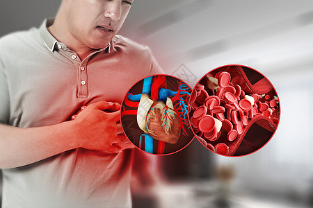 血管堵塞心脏病设计图片