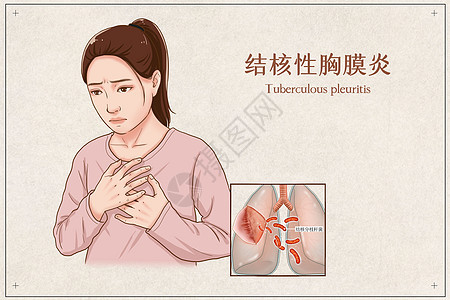 结核性胸膜炎医疗插画图片