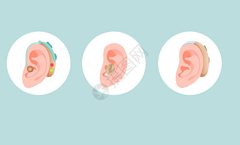 医疗机械各种助听器组合，图片