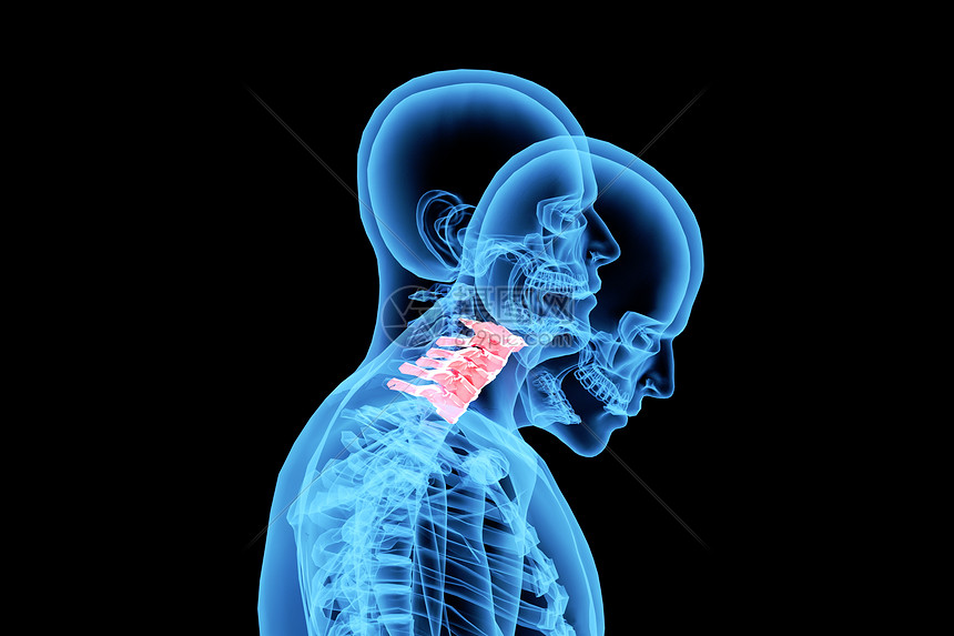 C4D颈椎病背景图片