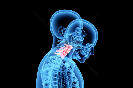 C4D颈椎病背景图片