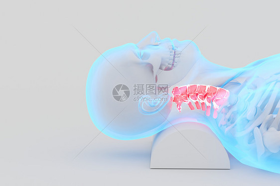 C4D颈椎疾病图片