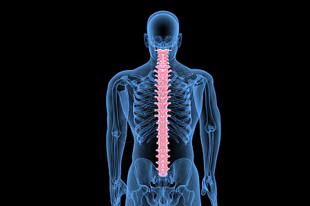 直10C4D骨科脊柱设计图片