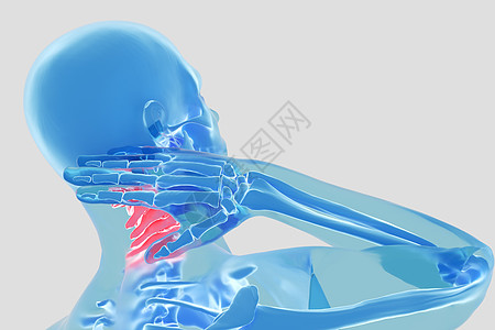 颈椎疾病高清图片