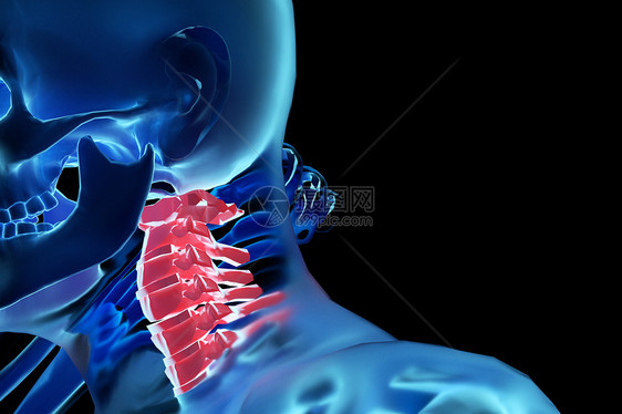 三维颈椎病场景图片