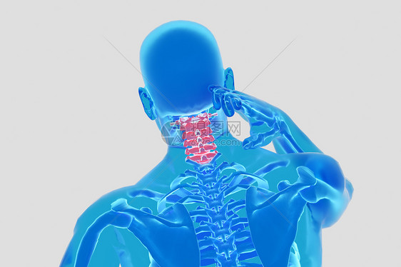 三维颈椎病场景图片