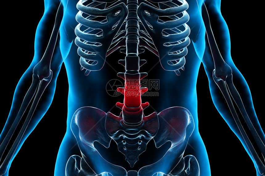 人体腰椎疾病图片