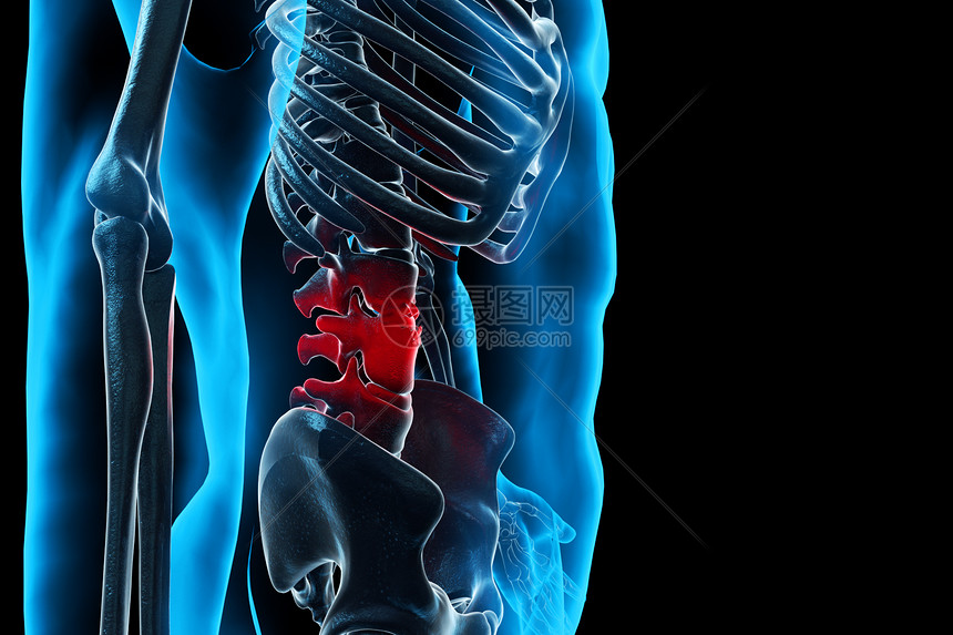 人体腰椎疼痛图片
