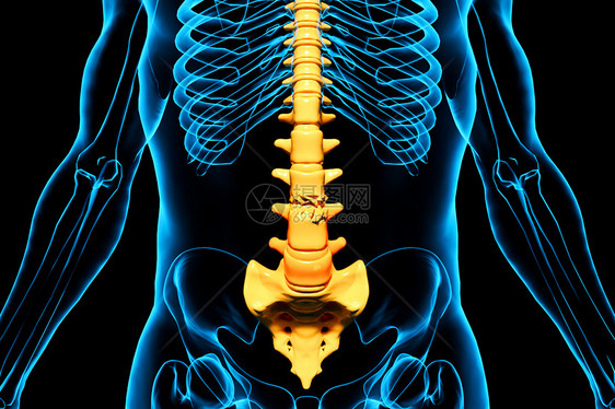 人体腰椎骨折图片