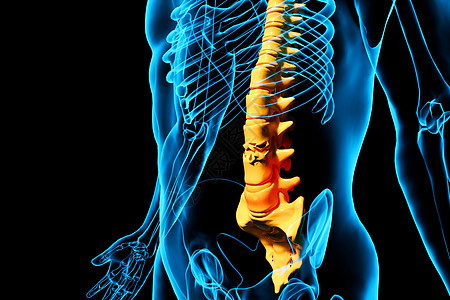 腰背部腰椎疾病设计图片