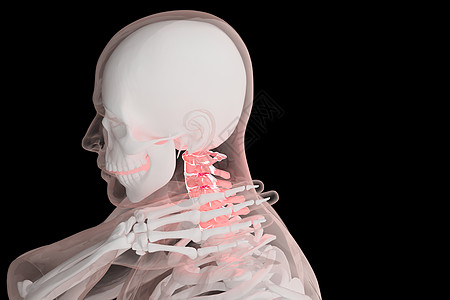 三维颈椎病场景高清图片
