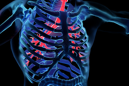 肺部x光C4D肺部感染背景设计图片