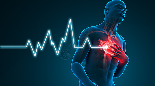 人体器官心脏病，冠心病，心肌梗塞场景设计图片