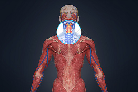 3d颈椎疾病场景图片素材