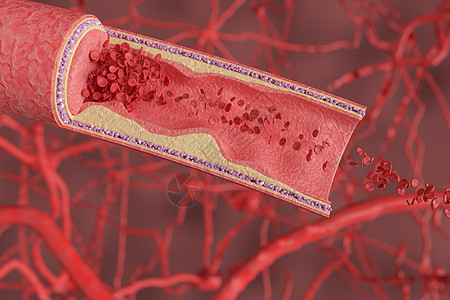 胆固醇人体血管场景设计图片