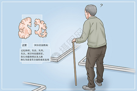 阿尔茨海默病迷路的老人医疗插画图片