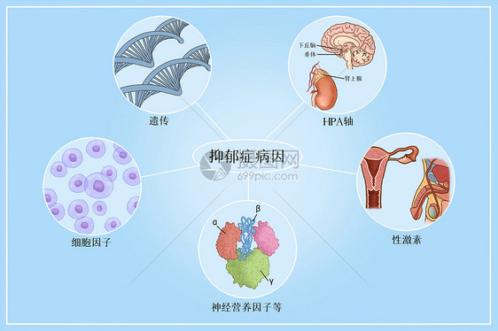 抑郁症病因医疗插画图片