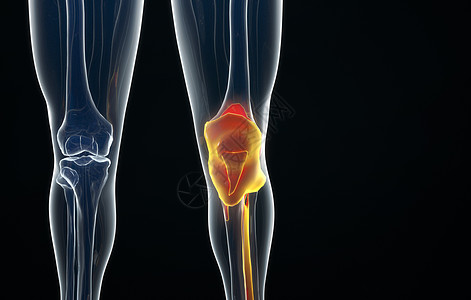 人体膝盖骨模型图片