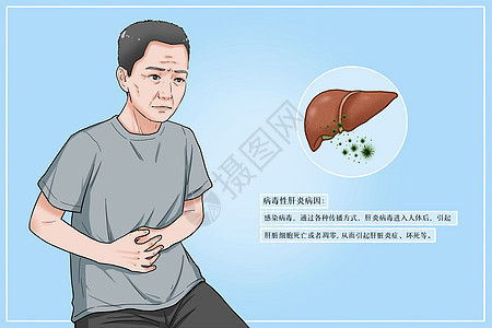 病毒性肝炎病因医疗插画图片