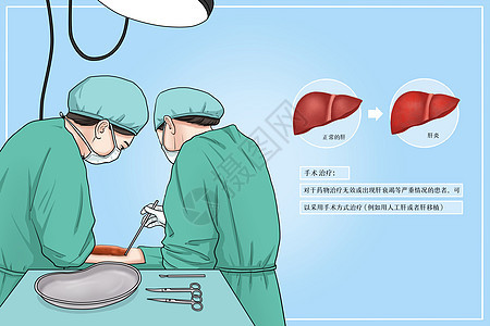 手术治疗肝炎医疗插画图片