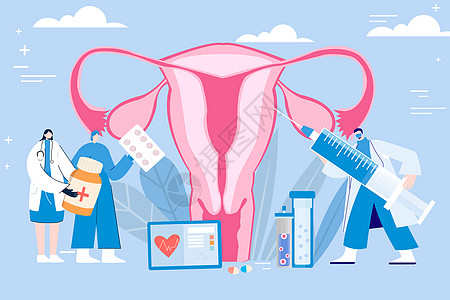 子宫卵巢妇科疾病矢量插画图片
