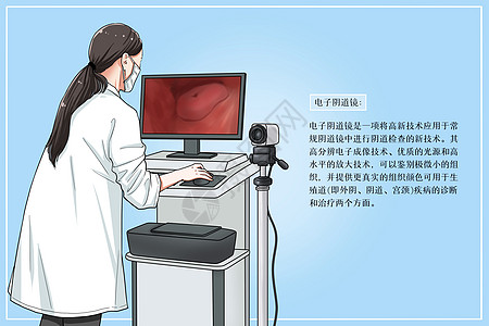 电子阴道镜检查医疗插画图片