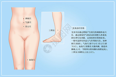 艾灸治疗宫寒医疗插画图片