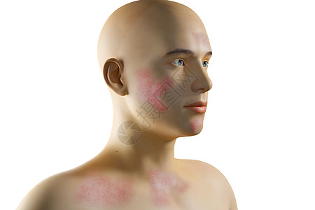 三维皮肤病场景图片素材