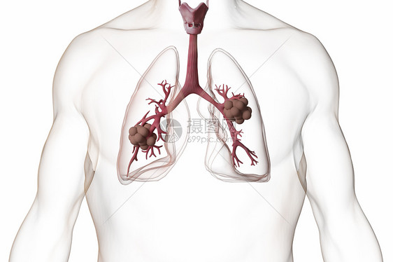 三维肺结核场景图片