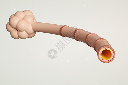 三维微观肺泡模型图片