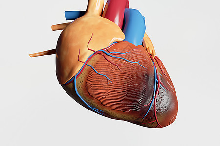 三维心绞痛场景图片