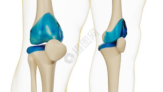 健康的膝关节-膝盖类风湿性关节炎背景图片