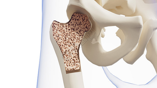 骨质疏松症背景图片