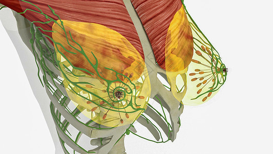 乳腺癌主动脉旁淋巴结肱骨高清图片