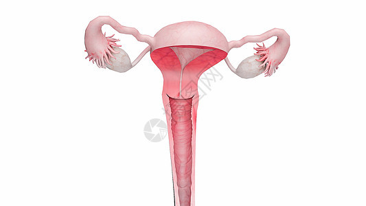 子宫颈癌图片