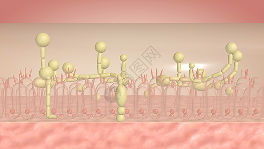 上皮细胞酵母菌感染治疗设计图片