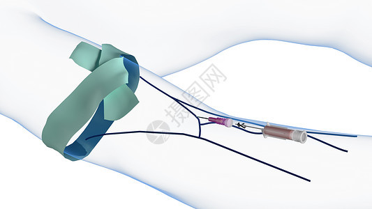 静脉注射针头取出图片