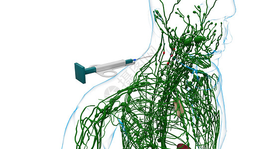 淋巴结活检淋巴结吸取高清图片
