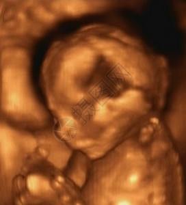 第四个月胎儿的三维图片