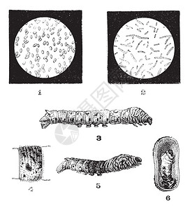 丝虫疾病古老的雕刻插图图片