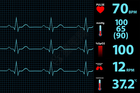 现代心电图显示器显示矢量图图片